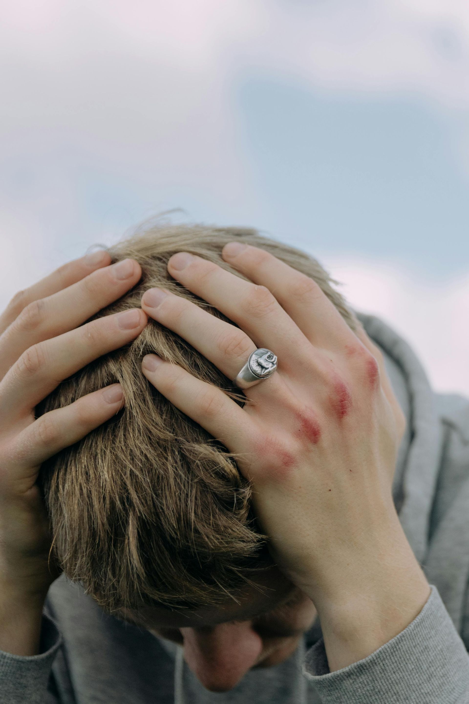 Man with head in hands, wearing a ring, appears distressed against a cloudy sky.