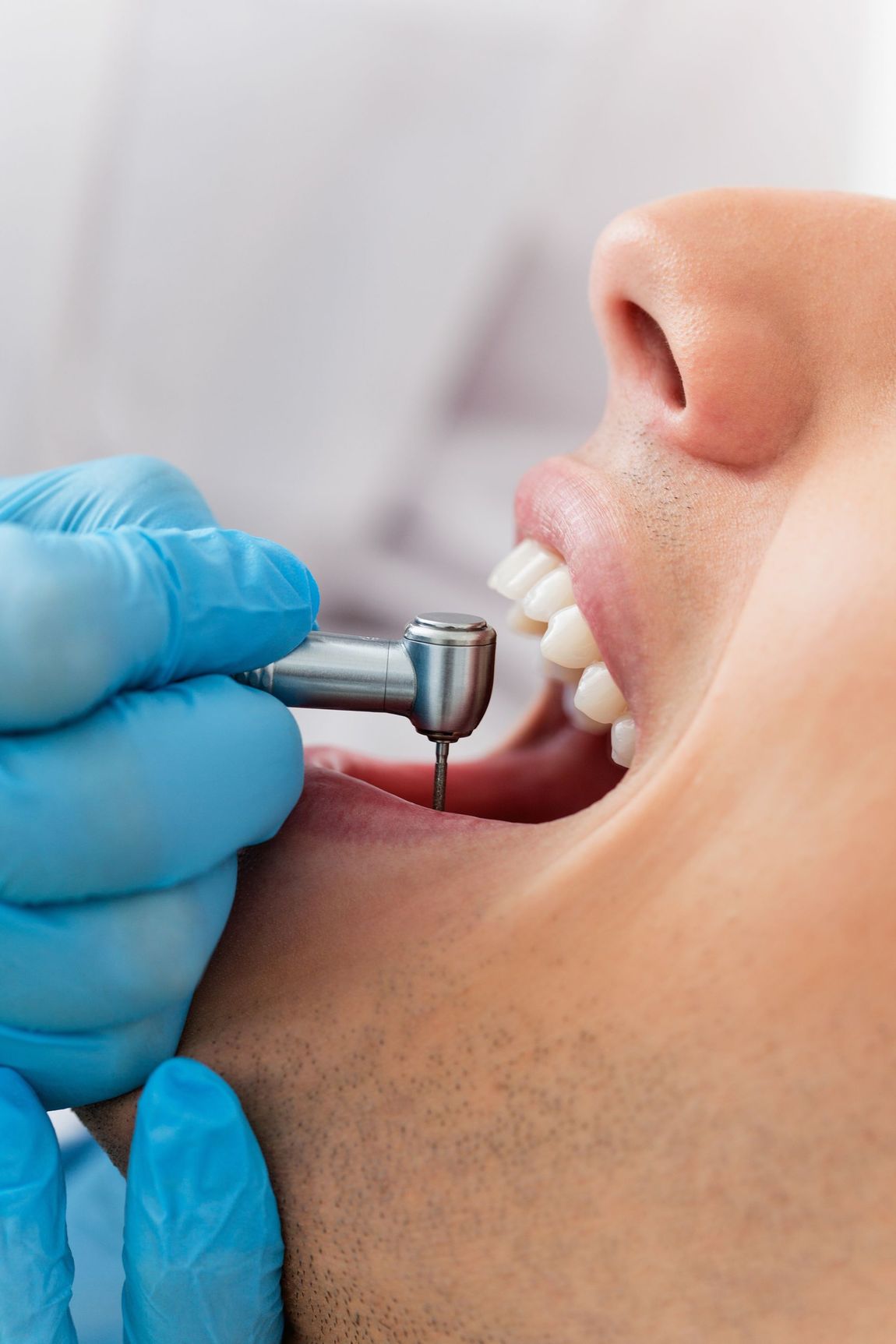 Trattamento dentale