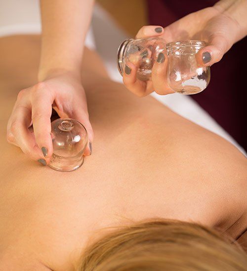 cupping therapy