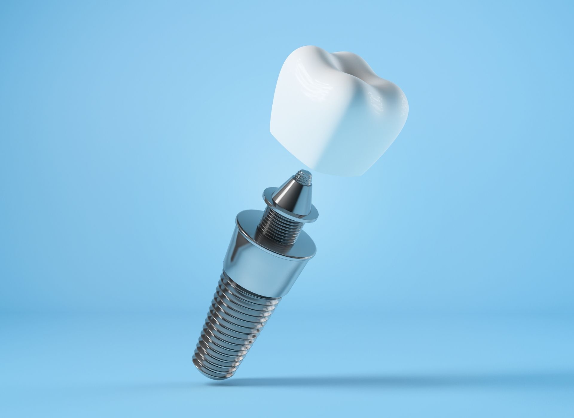 A dental implant shown as three separate components: the titanium screw, the abutment, and the white crown, on a blue background.