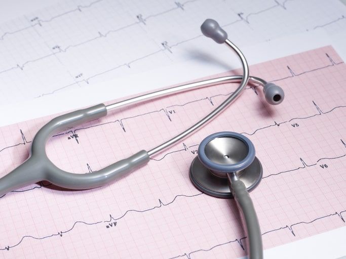 Two stethoscopes on a pink and white ECG printout