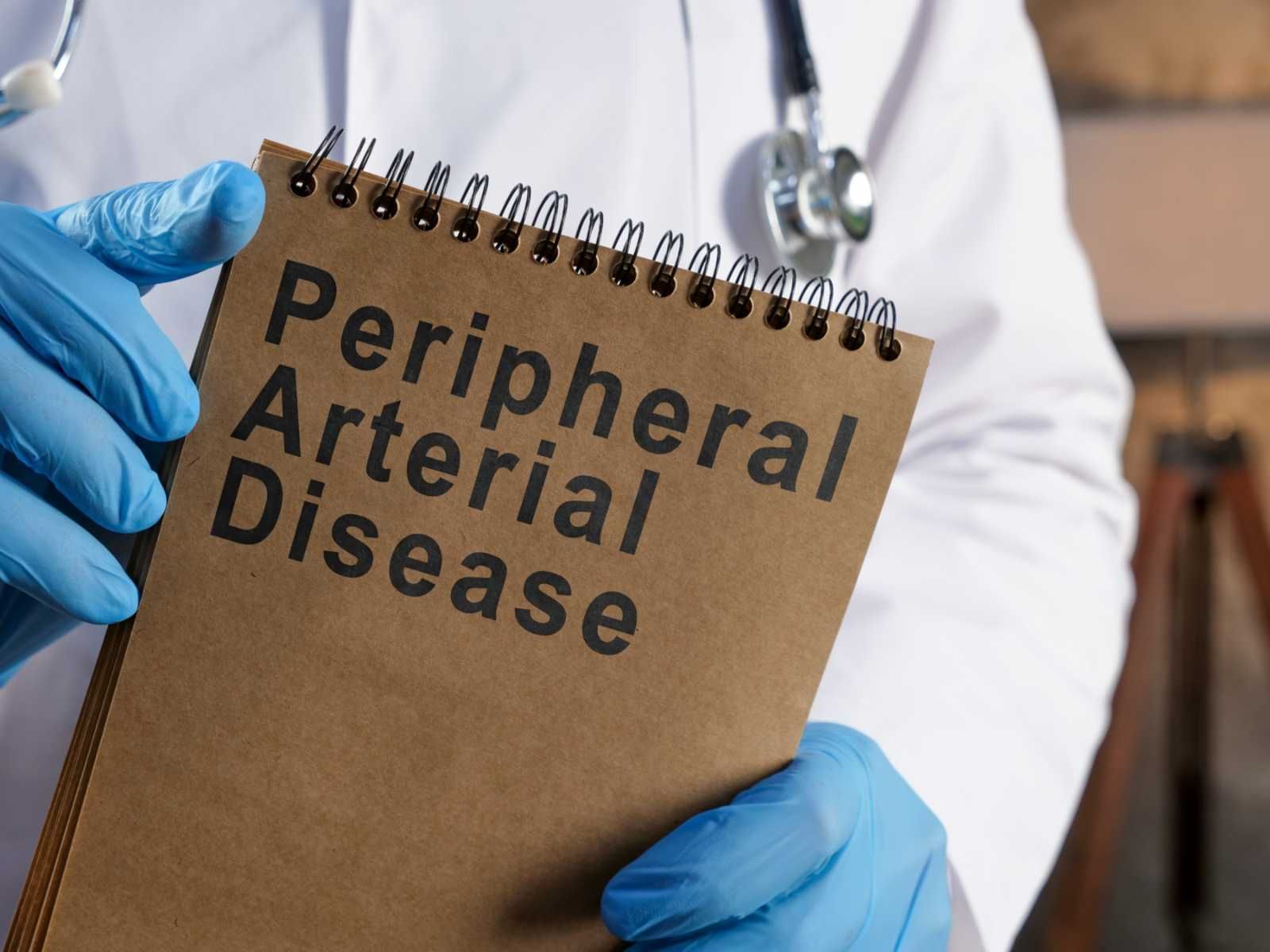 Gloved clinician holding a notepad labeled “Peripheral Arterial Disease”