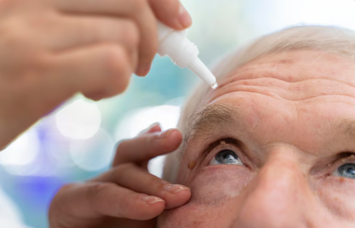 Tratamento para ceratocone Nova Friburgo: Quando a cirurgia é indicada?