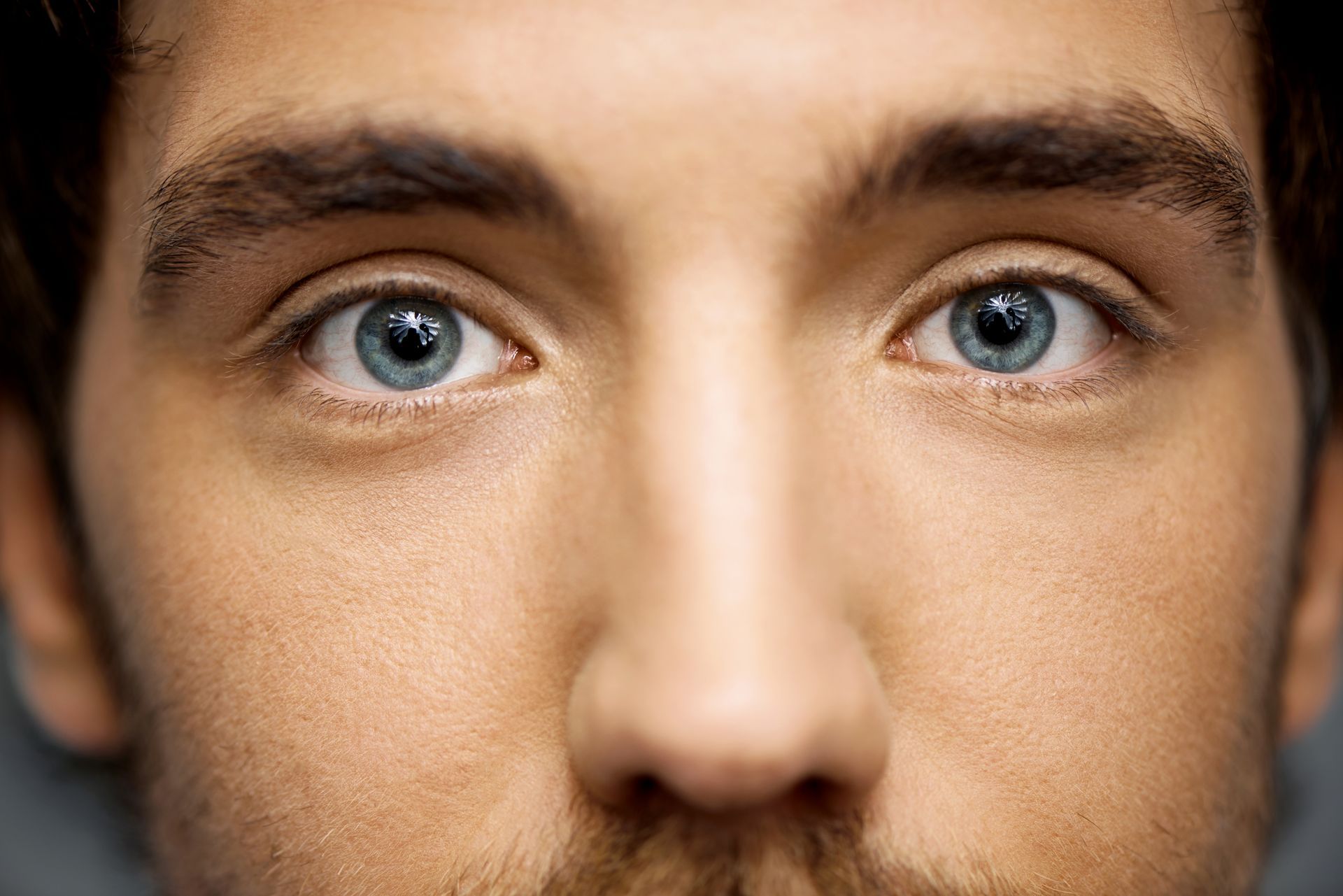 Tratamento para olhos separados no RJ Tratamento para olhos separados no RJ