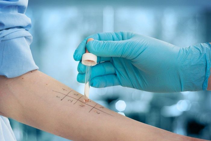 allergy testing