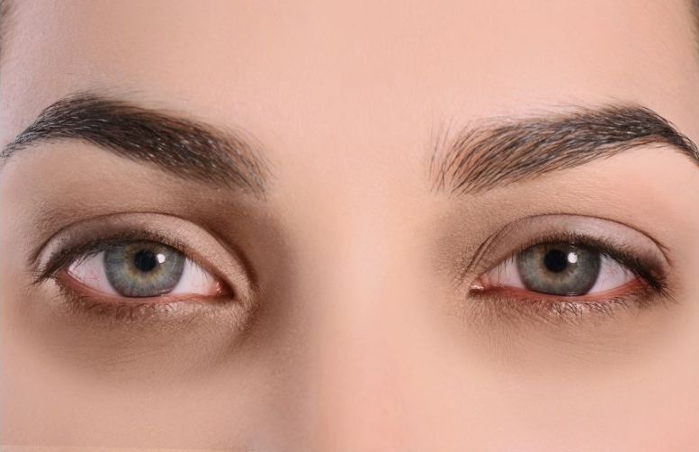 dark circles under eyes, dark circle, eye circles