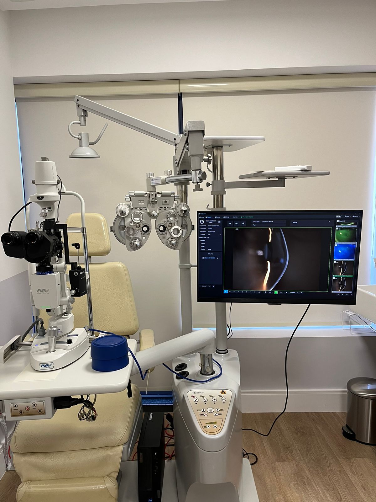 Fotodocumentação do Segmento Anterior em sp Fotodocumentação do Segmento Anterior em sp