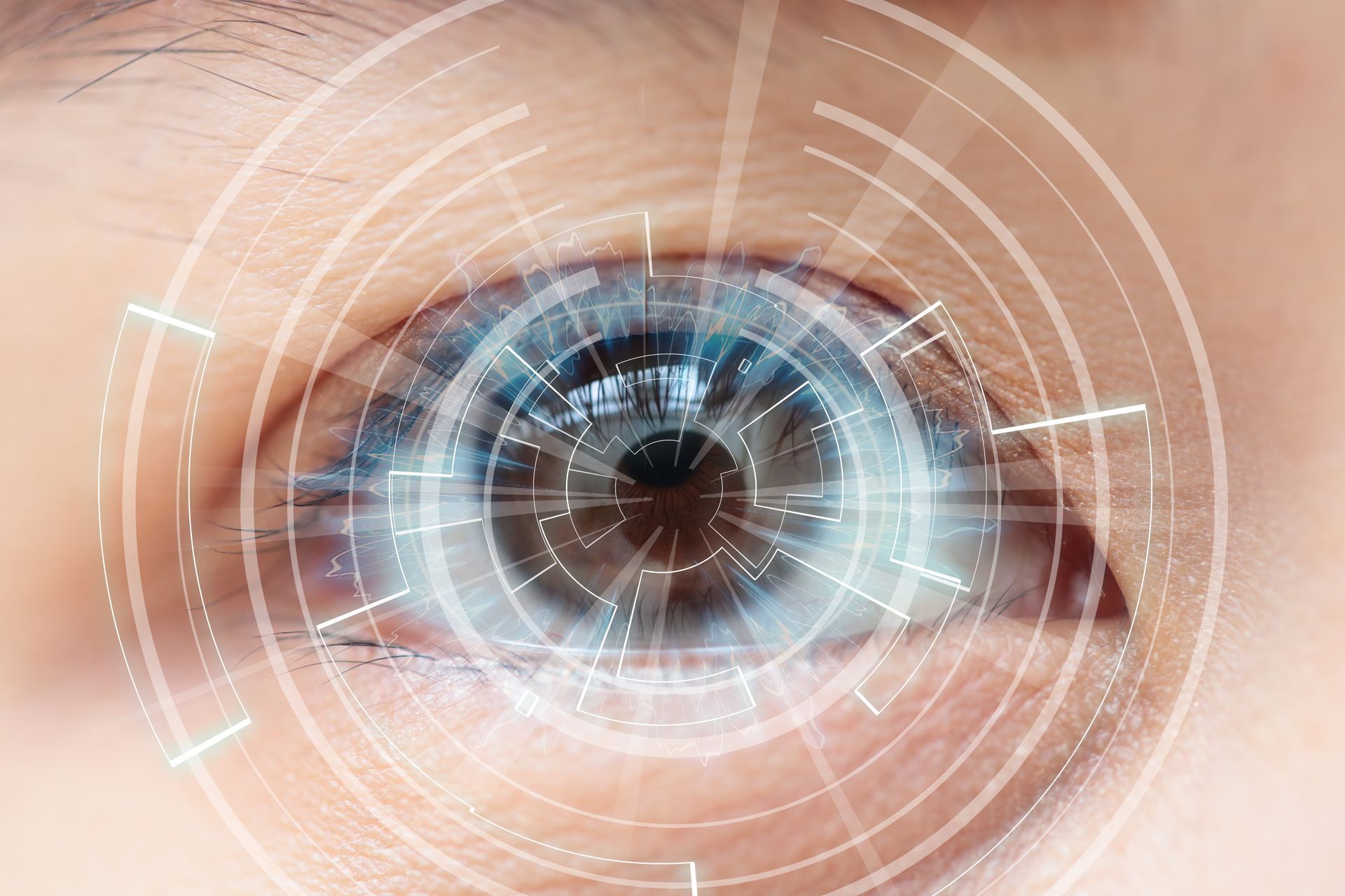 Especialistas em Cirurgia Refrativa em São Paulo Especialistas em Cirurgia Refrativa em São Paulo