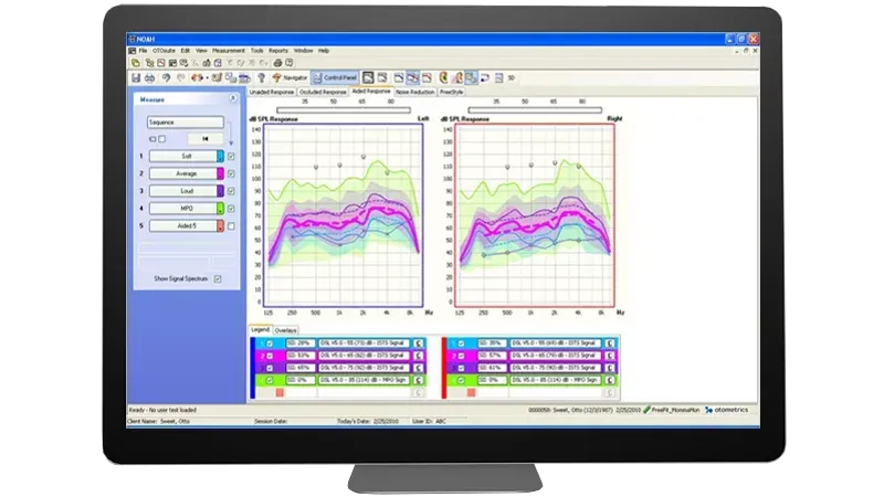 Aurical Freefit software displaying real ear measurement curves and fitting targets