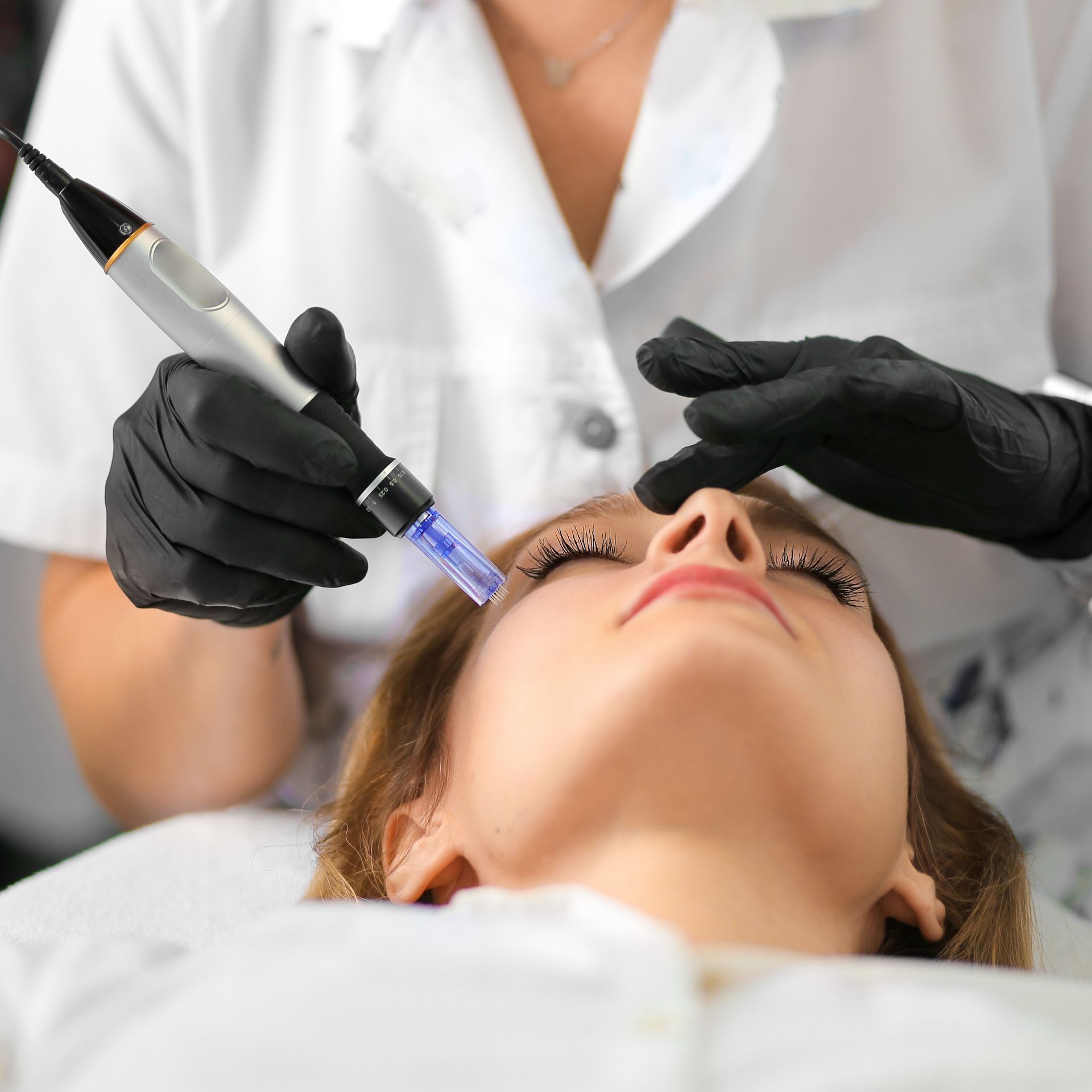 woman getting microneedling