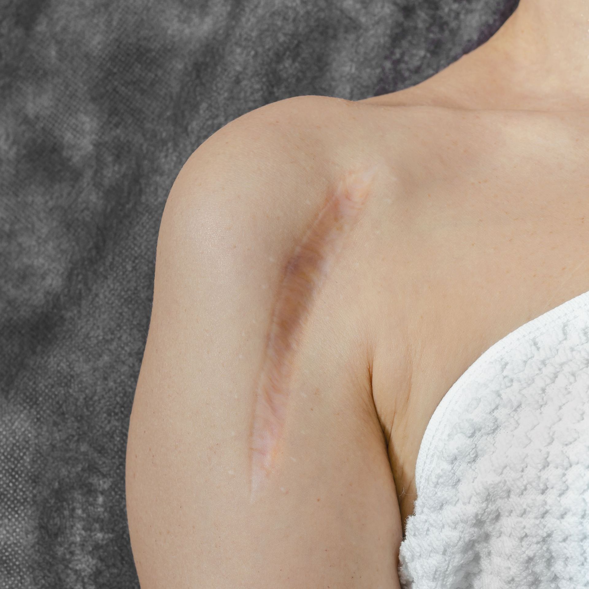 woman with scar