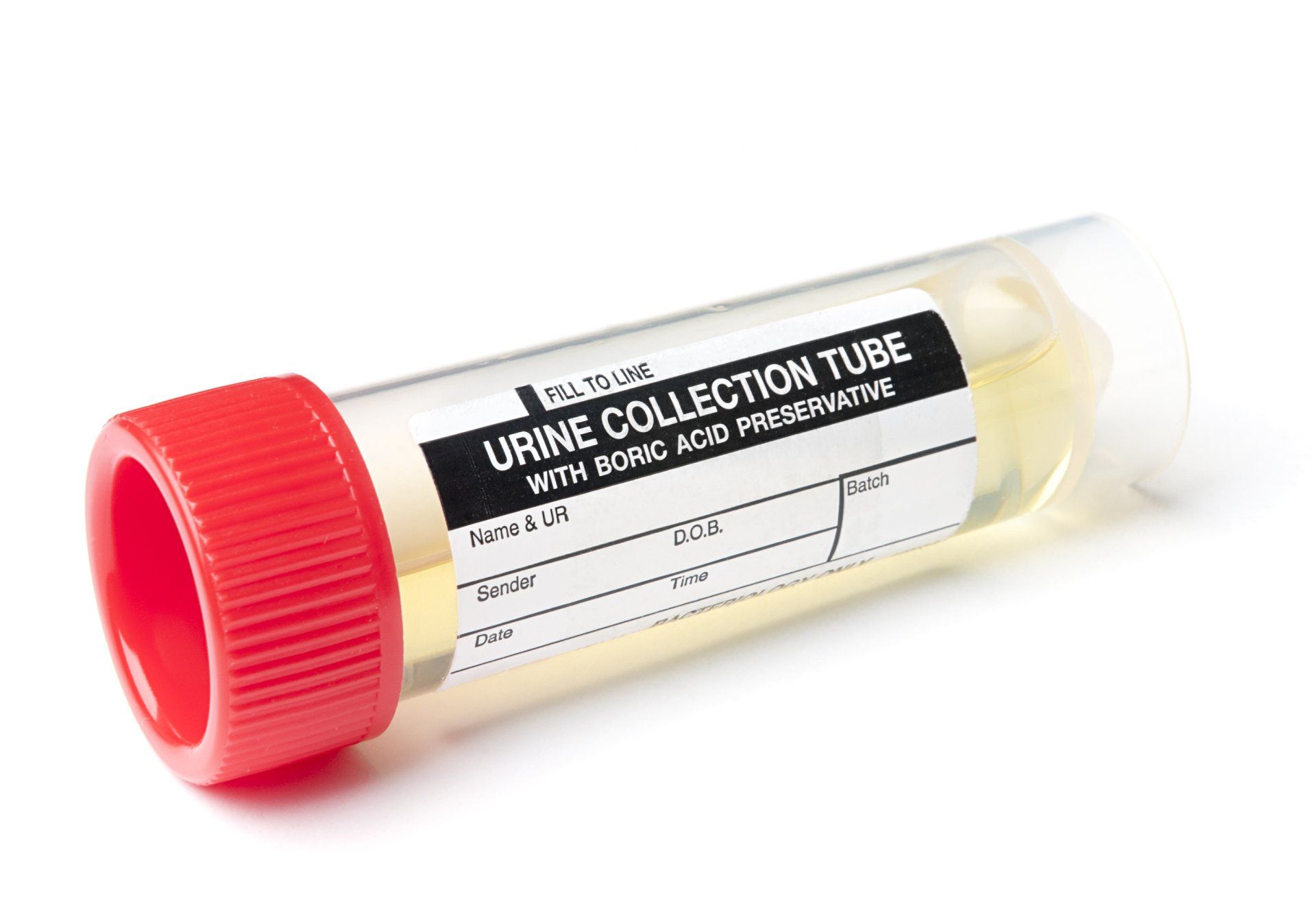 Urine Sample - San Antonio, TX - Canopy Employment Screening Urine Sample - San Antonio, TX - Canopy Employment Screening