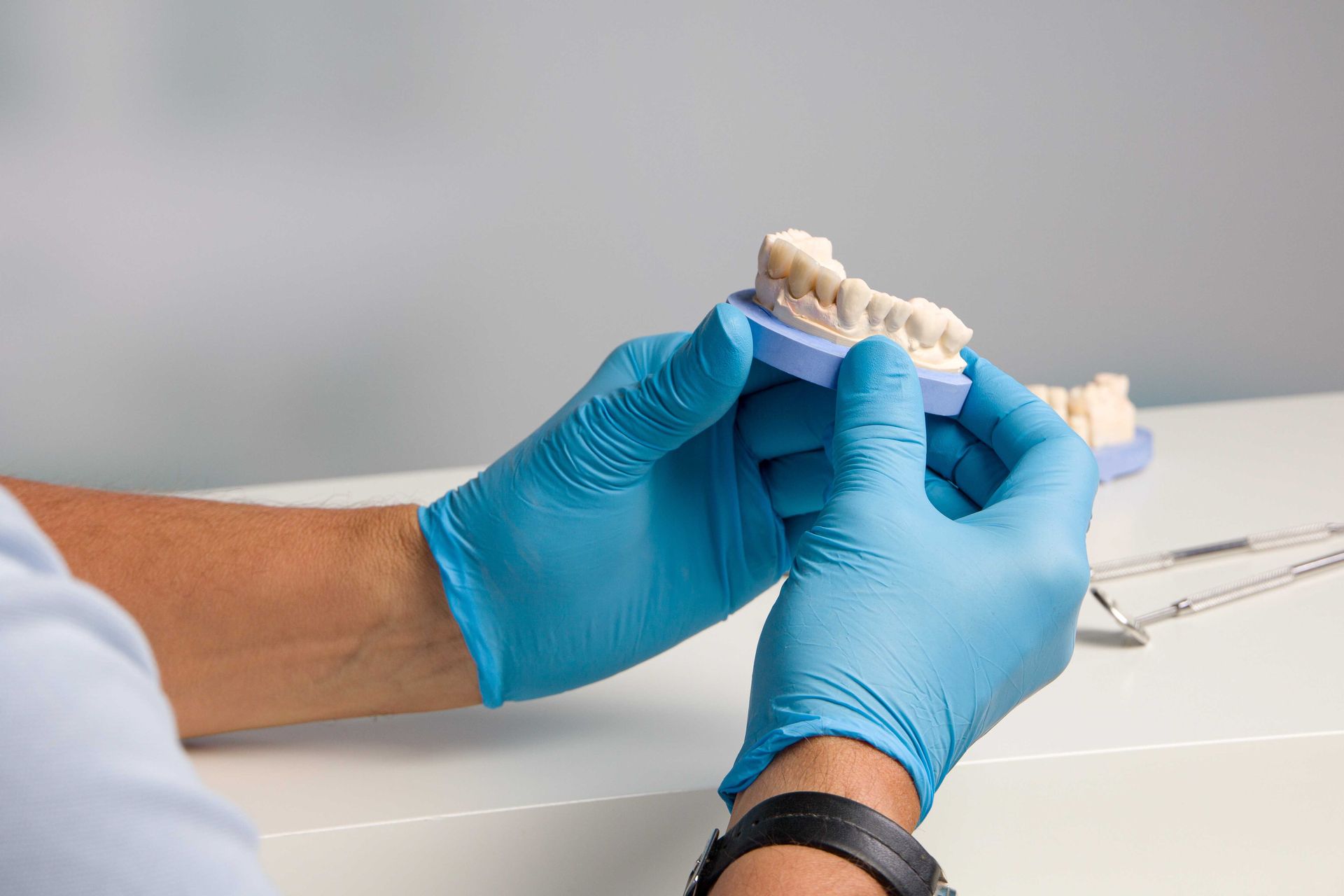 Mani guantate di blu che reggono uno stampo dentale in un ambiente clinico.