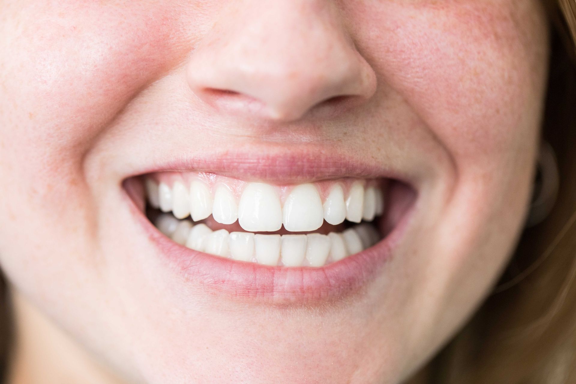 Primo piano di una bocca sorridente con denti bianchissimi e labbra rosa.