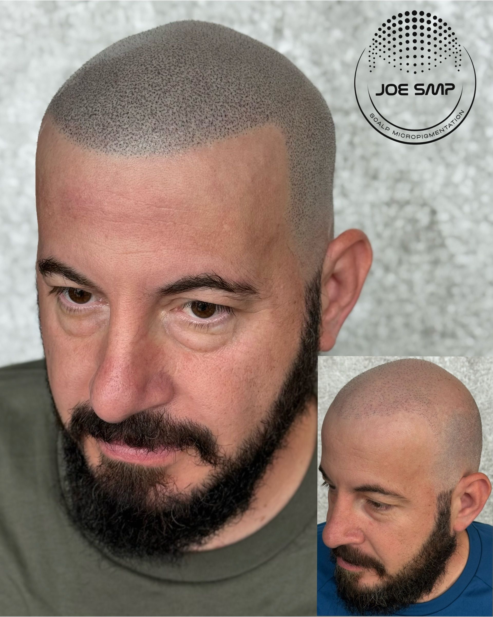 Man with a shaved head and beard, showing scalp micropigmentation. Inset of his head, with the Joe Gav logo.