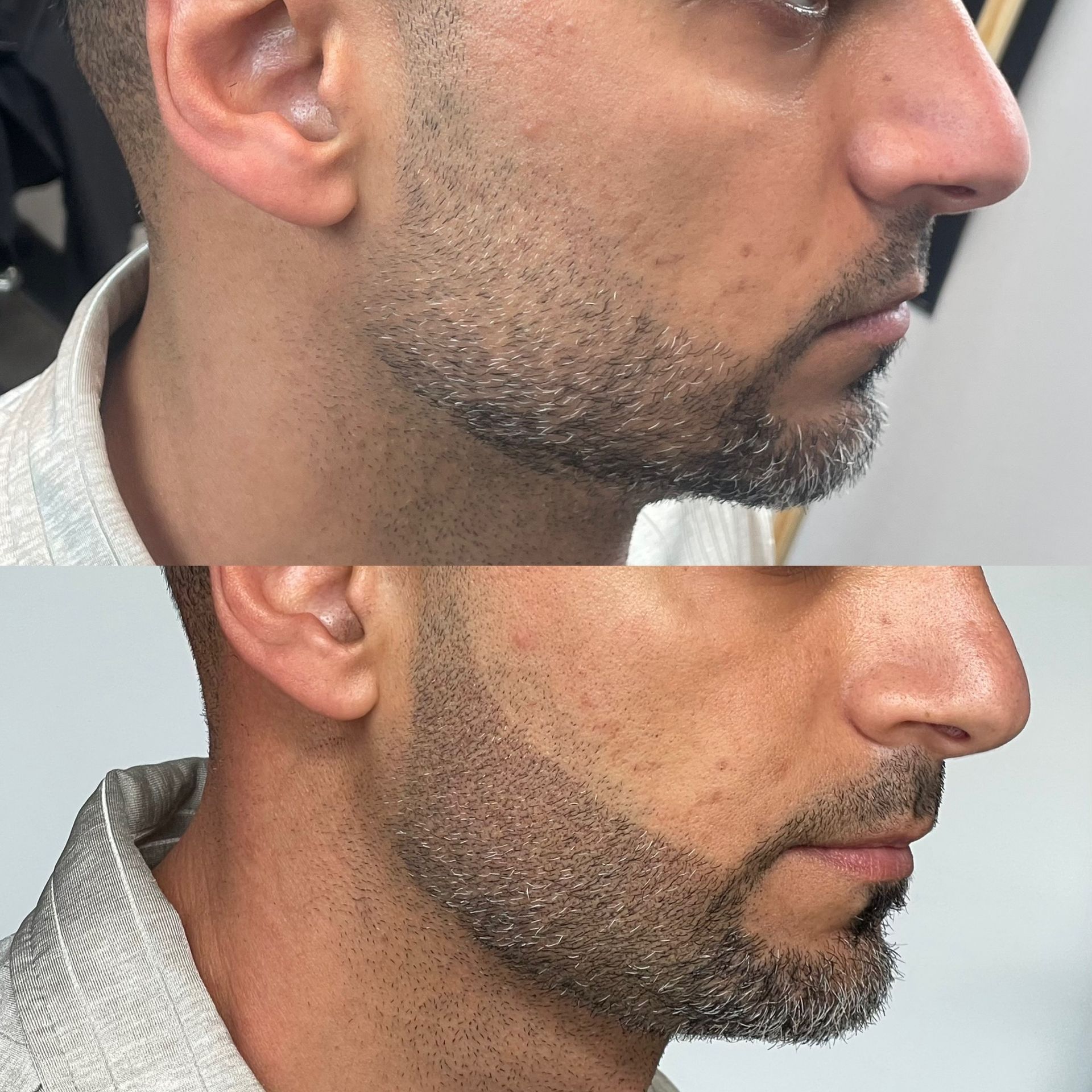 Two side-by-side beard grooming shots. Before and after a trim, shaping a beard and cheek line.