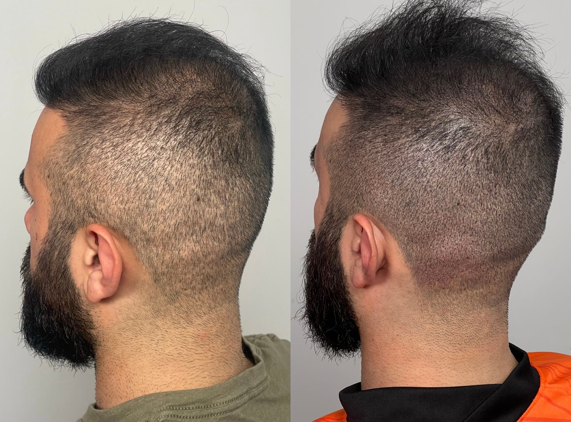 Two side-by-side photos of a man with a faded haircut, showing the back of his head and neck.