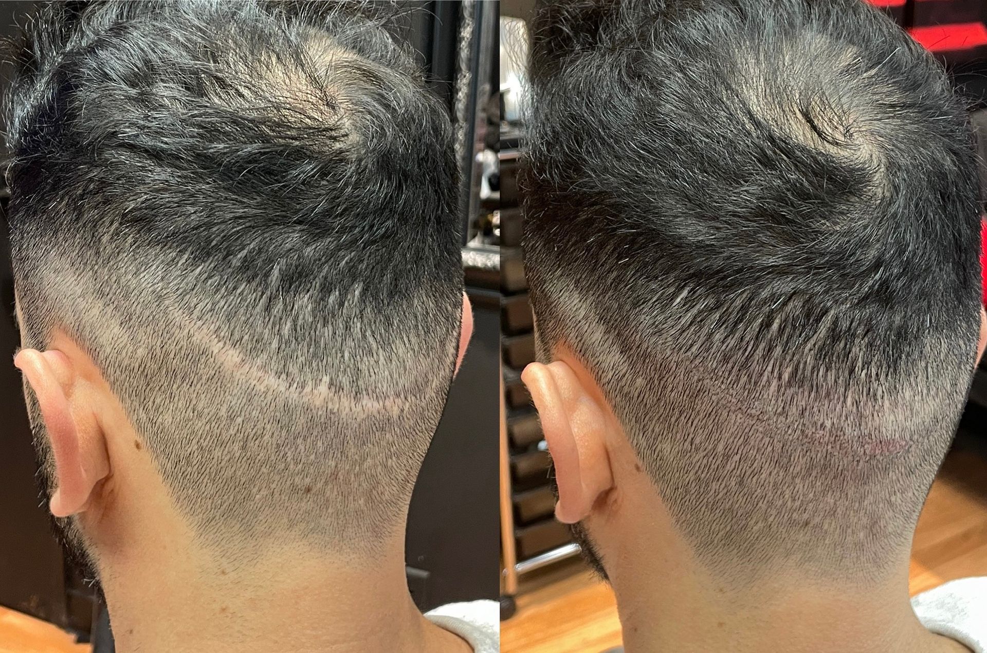 Two views of a person's head showing a faded haircut on the lower back of the head.