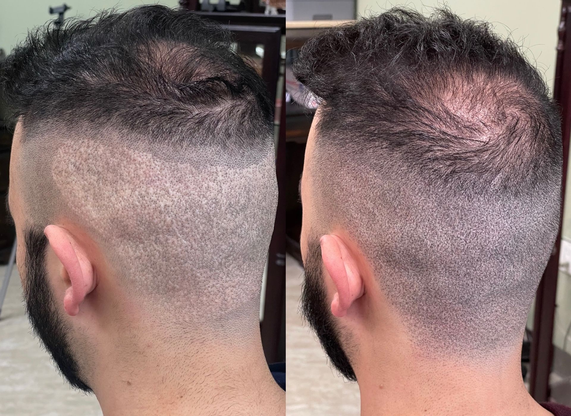 Two side-by-side photos of the back of a man's head. The hair is buzzed on the sides and back, with longer hair on top.