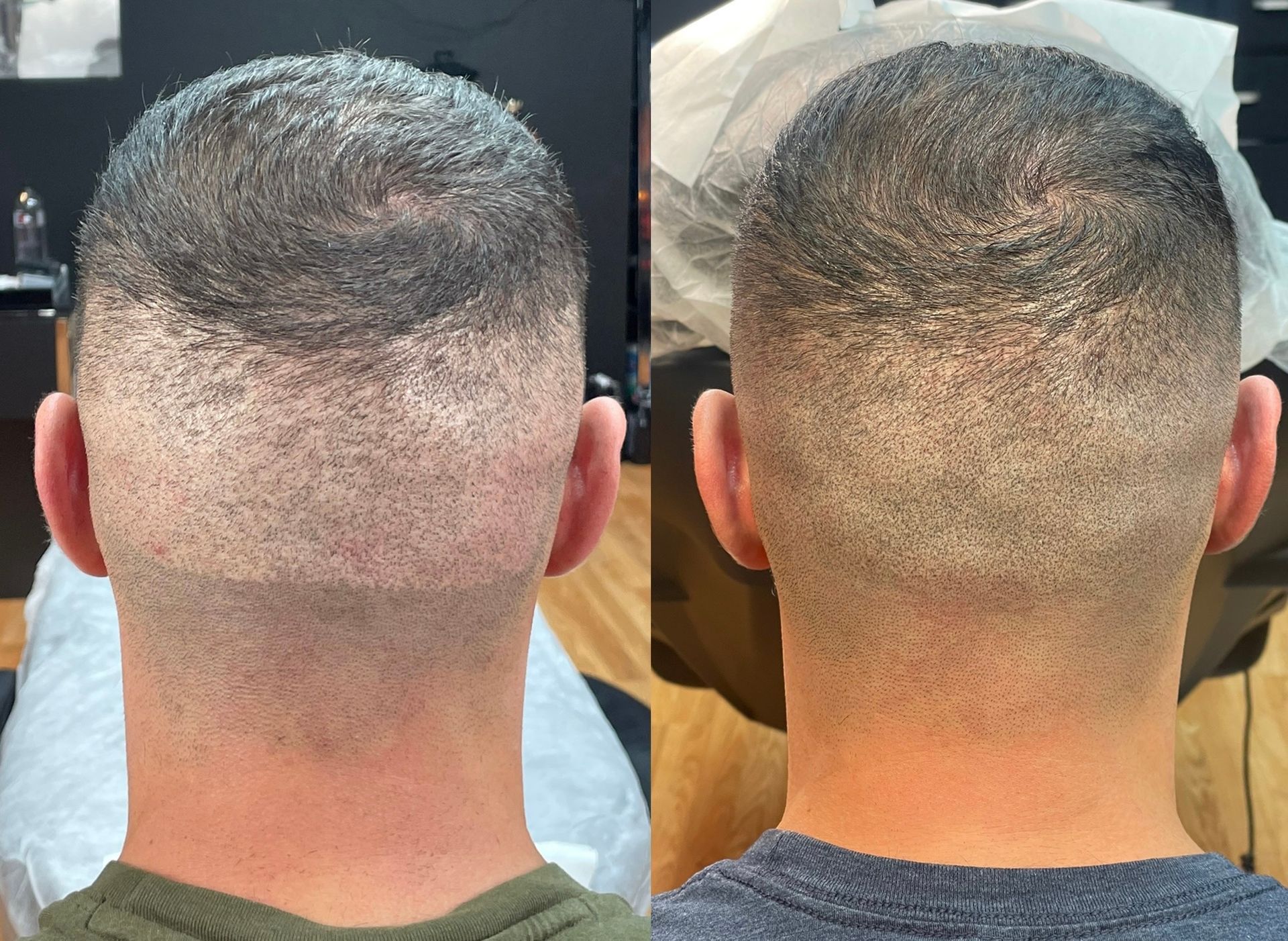 Two views of a person's head after a haircut, showing a faded nape and short hair on top.