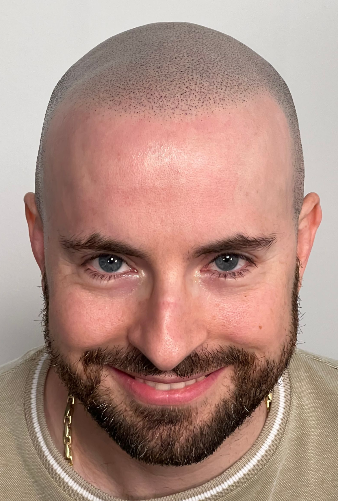 Man with a shaved head and beard smiles at the camera, wearing a gold chain and light-colored shirt.