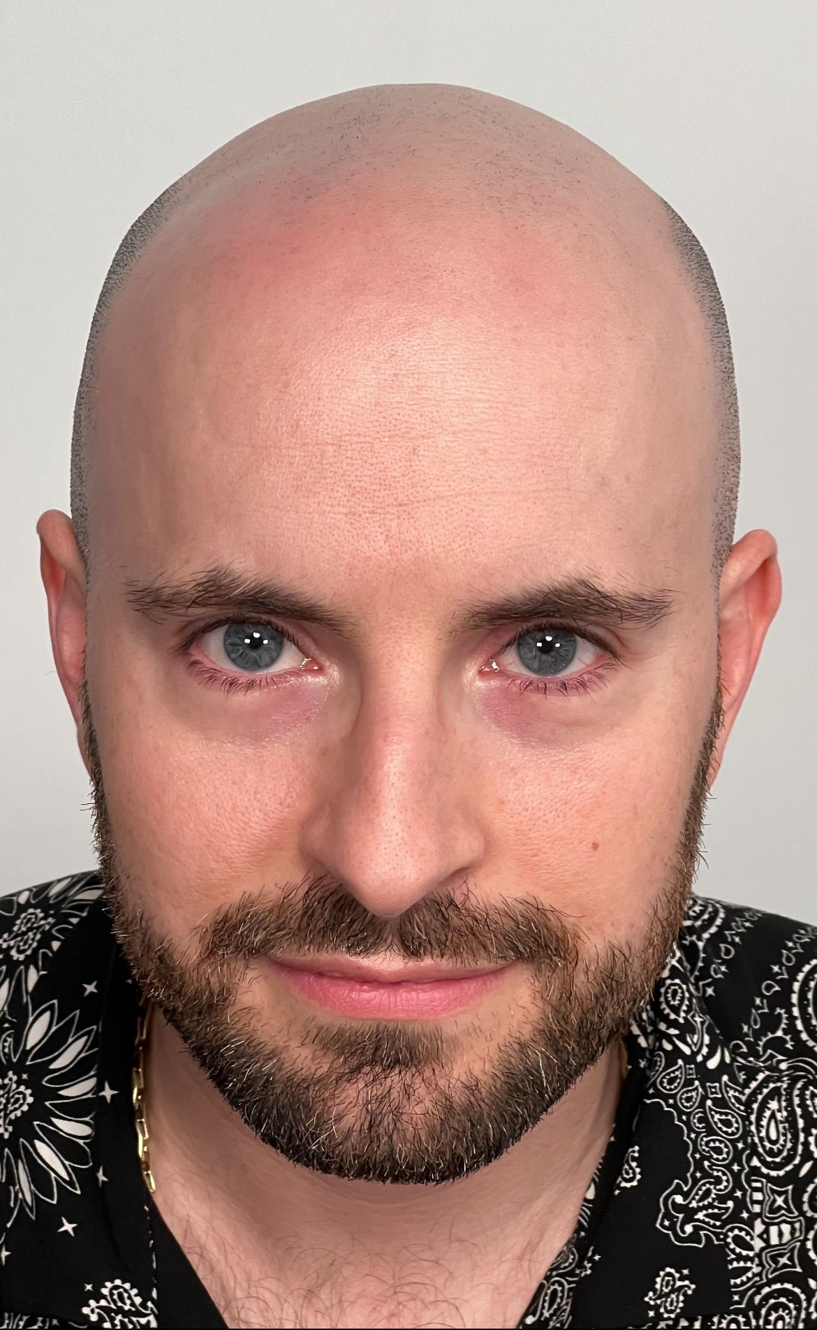 Bald man with blue eyes and a short beard, wearing a patterned shirt.