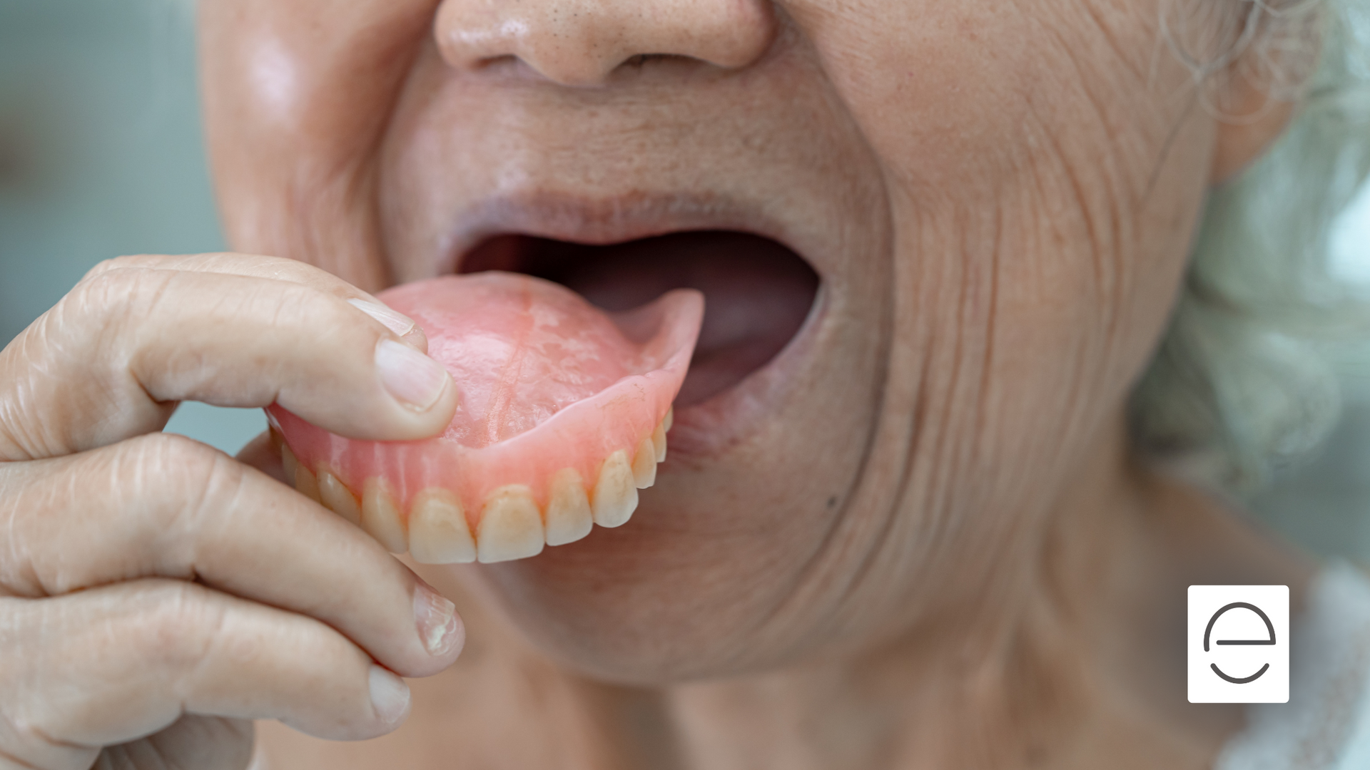 Red Partials Dealing with Sore Spots from Dentures: Causes and Solutions