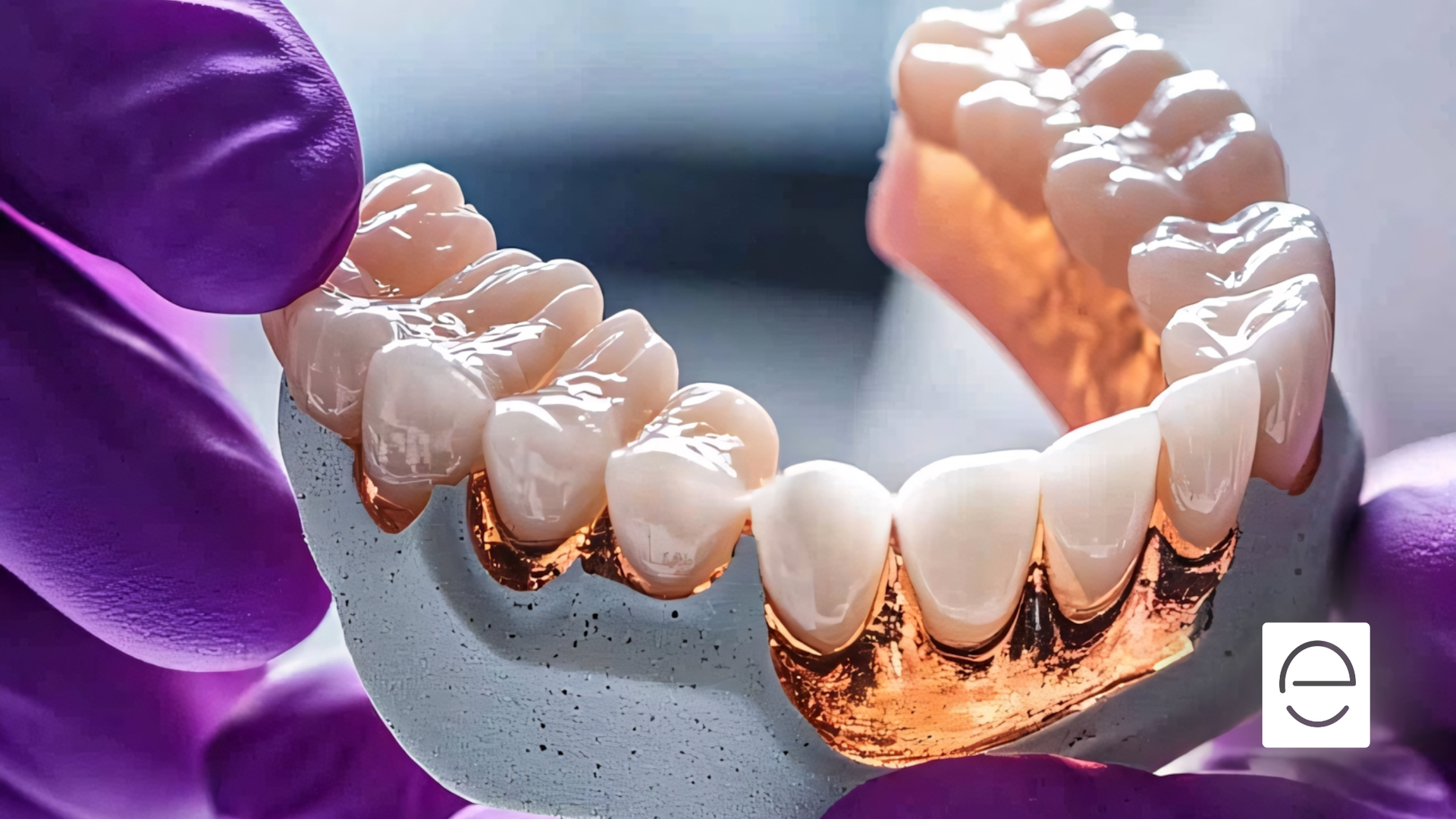 Partial dental prosthetic model held by gloved hands, showcasing teeth.