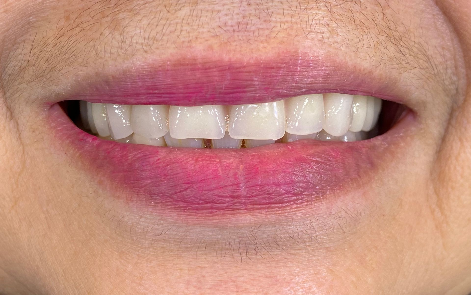 Close-up of a smiling mouth with pink lipstick and visible teeth
