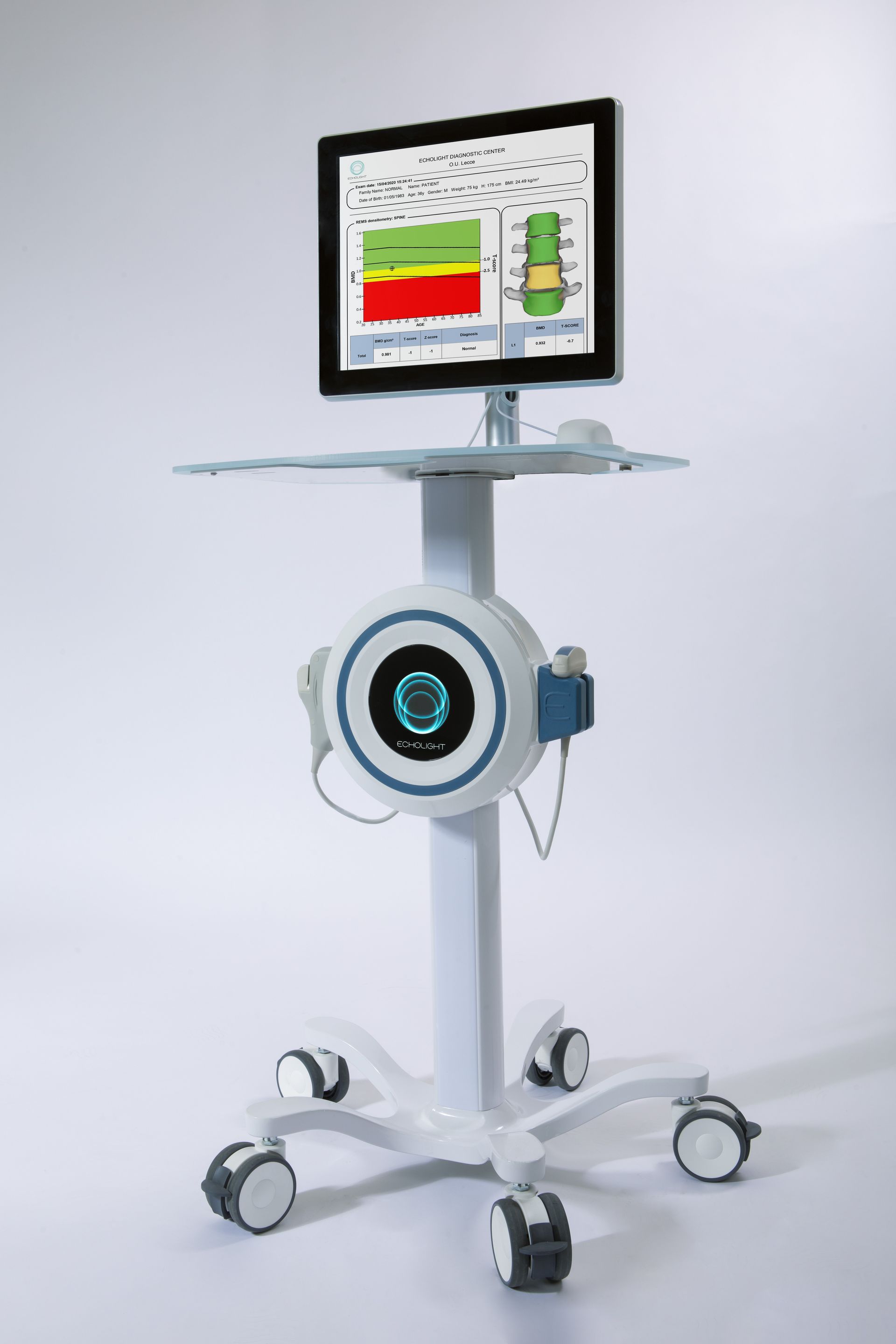 A white cart with a monitor on top of it