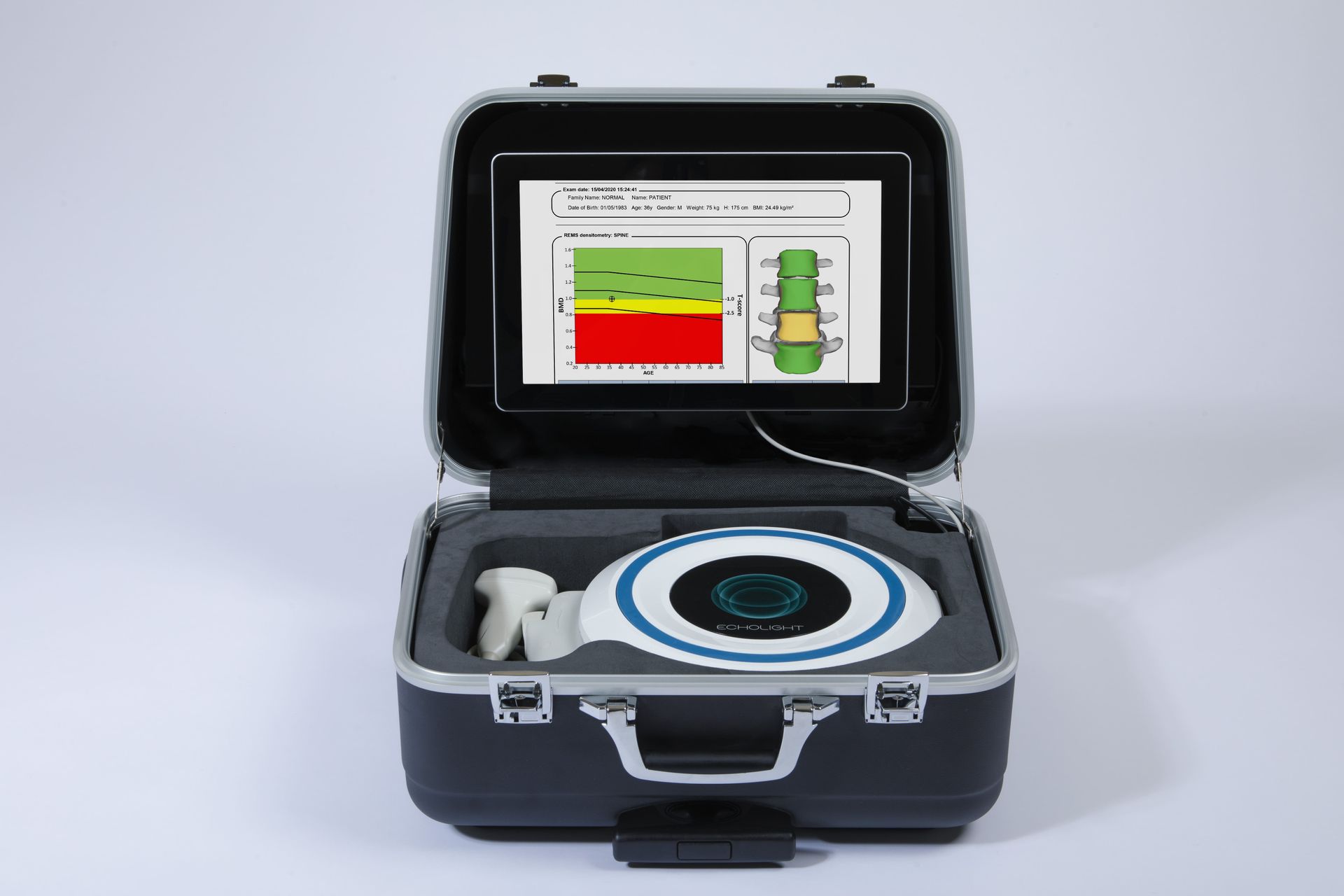 A briefcase with a screen that says ' rc ' on it