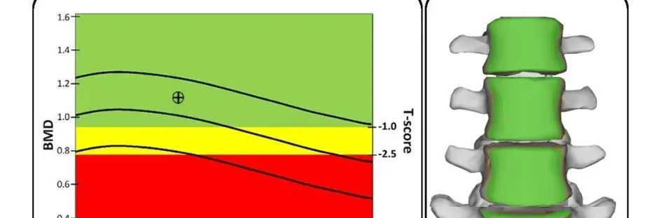 Colored spine pressure chart and a 3D green vertebrae model side by side.