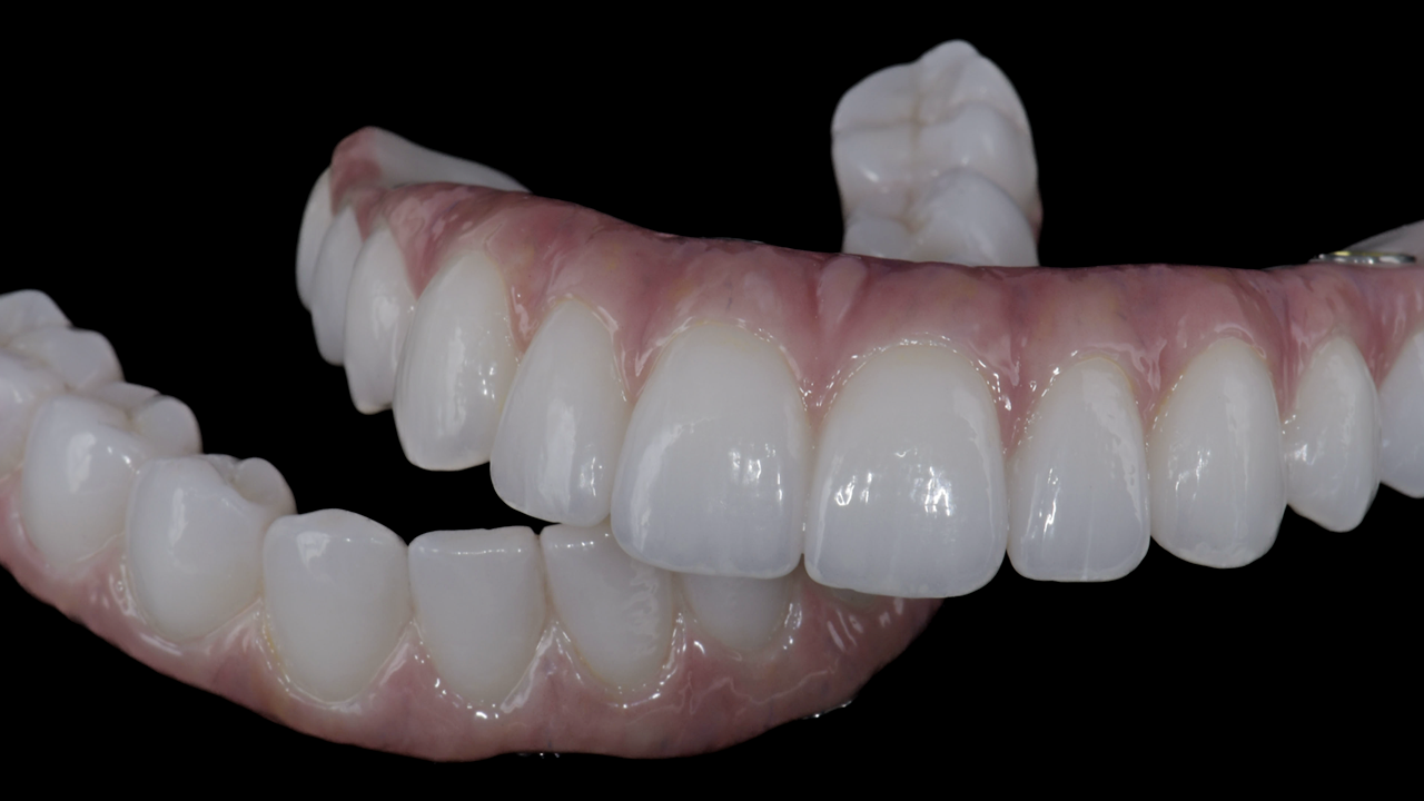Close-up of a set of upper and lower dentures, with white teeth and pink gums, against a black background.