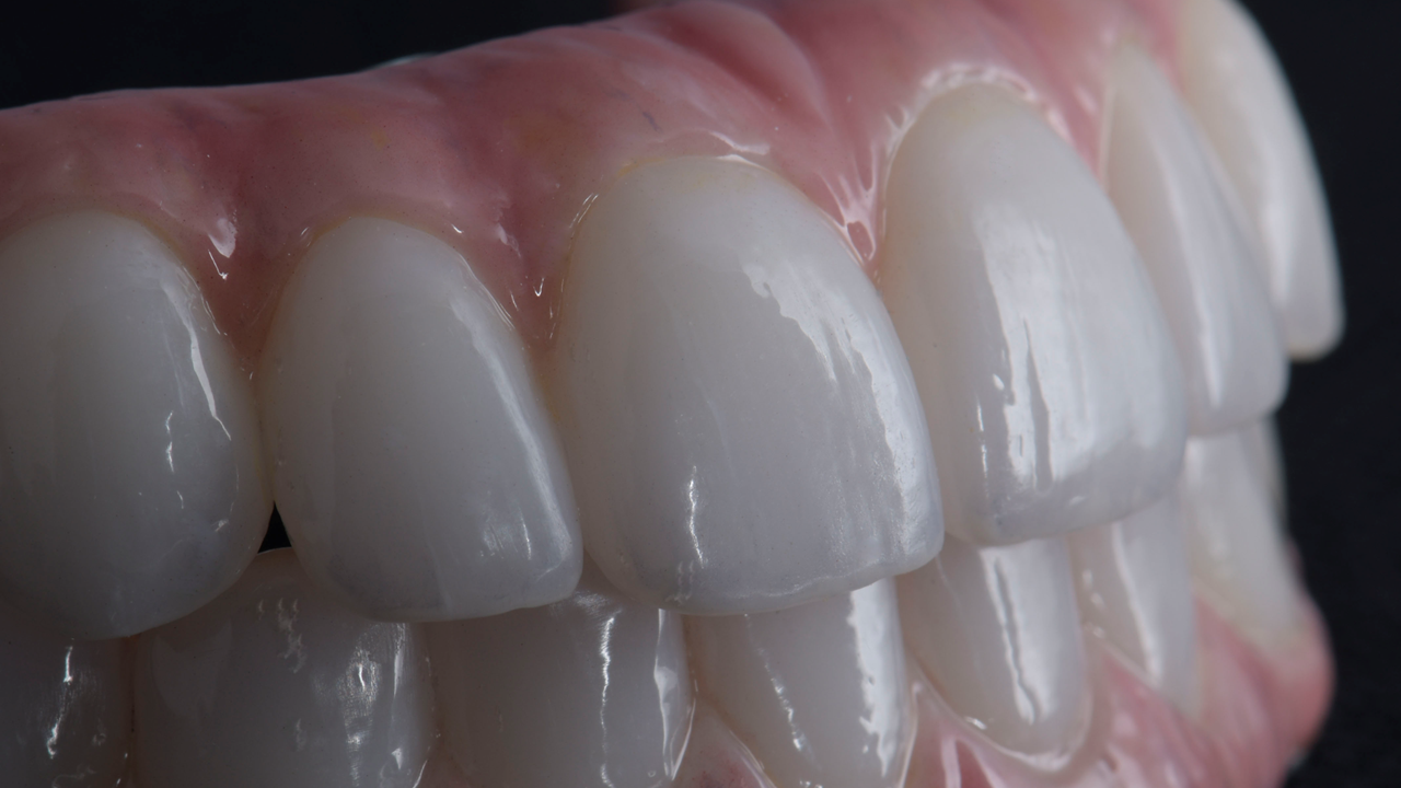 Close-up of a set of prosthetic teeth with pink gums, showing the upper and lower teeth, with a black background.
