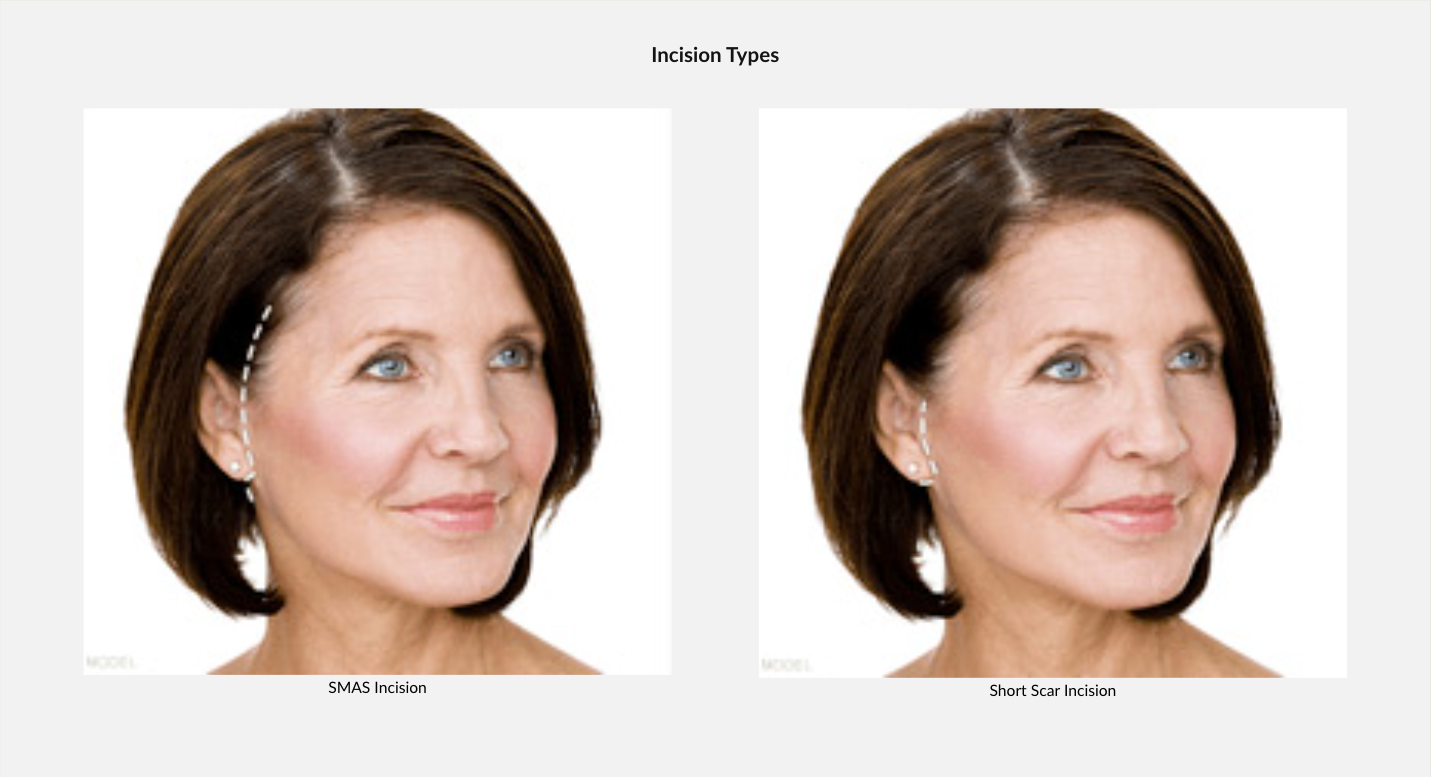 Side-by-side comparison of a woman's face. Left shows facial imperfections, right shows a smoothed version.