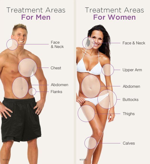 Diagram showing potential treatment areas on men and women's bodies.