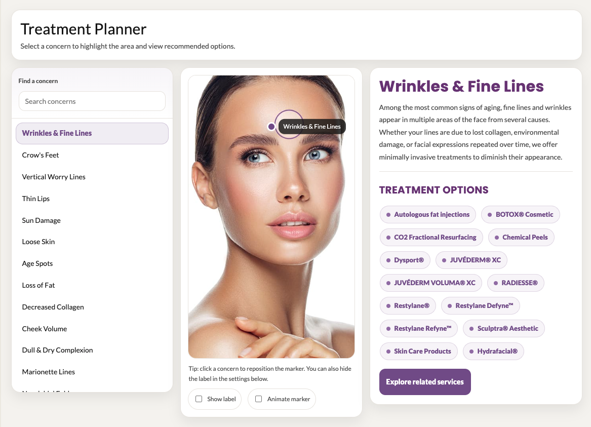 Treatment planner interface showing a woman's face with highlighted forehead wrinkles, and treatment options.