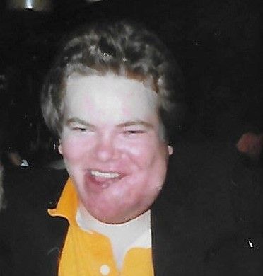 A man with a bloated left cheek in a yellow shirt.