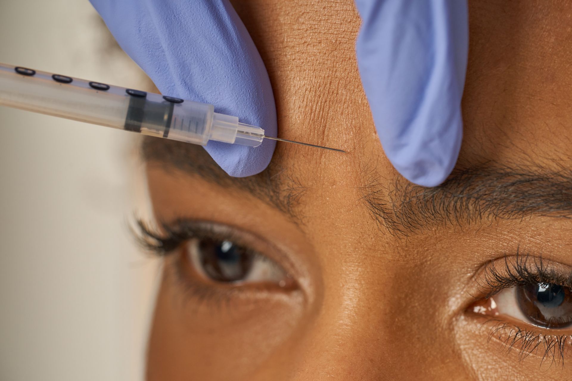 Close-up of Botox injection into forehead at Clinica Santa Maria Wellness Med Spa in Brownsville, TX.