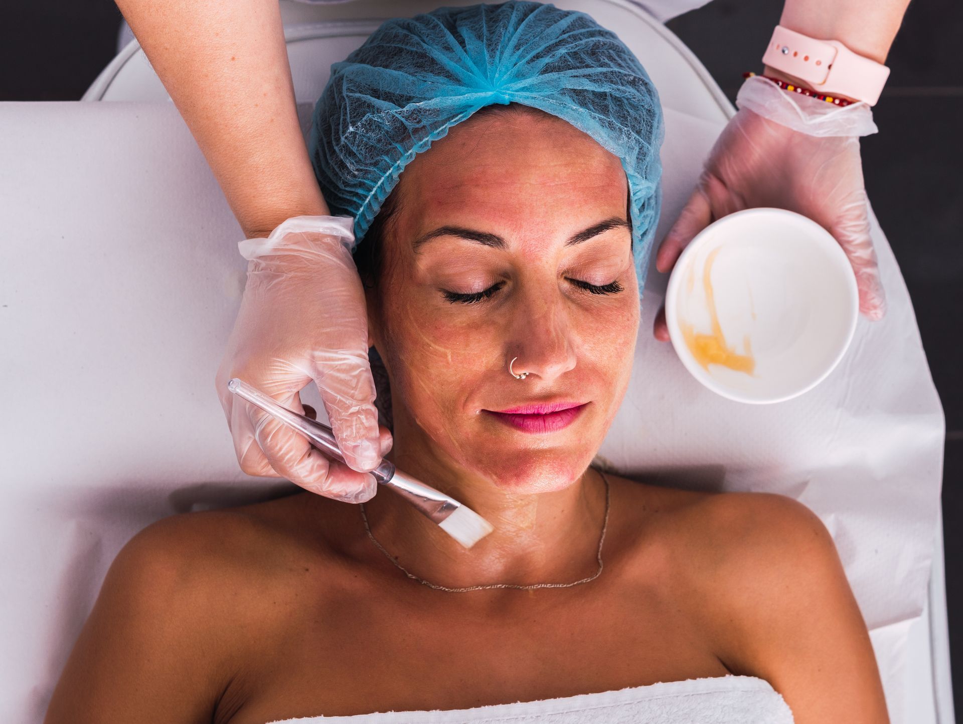 Chemical peel facial at Clinica Santa Maria Wellness Med Spa in Brownsville, TX for skin renewal.