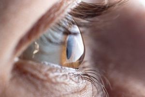 rappresentazione servizi oculistici dell'oculista a Monza