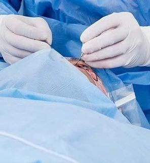 intervento di chirurgia oculistica del medico oculista di Monza