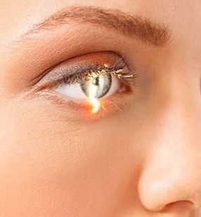 controllo della vista del medico oculista di Monza