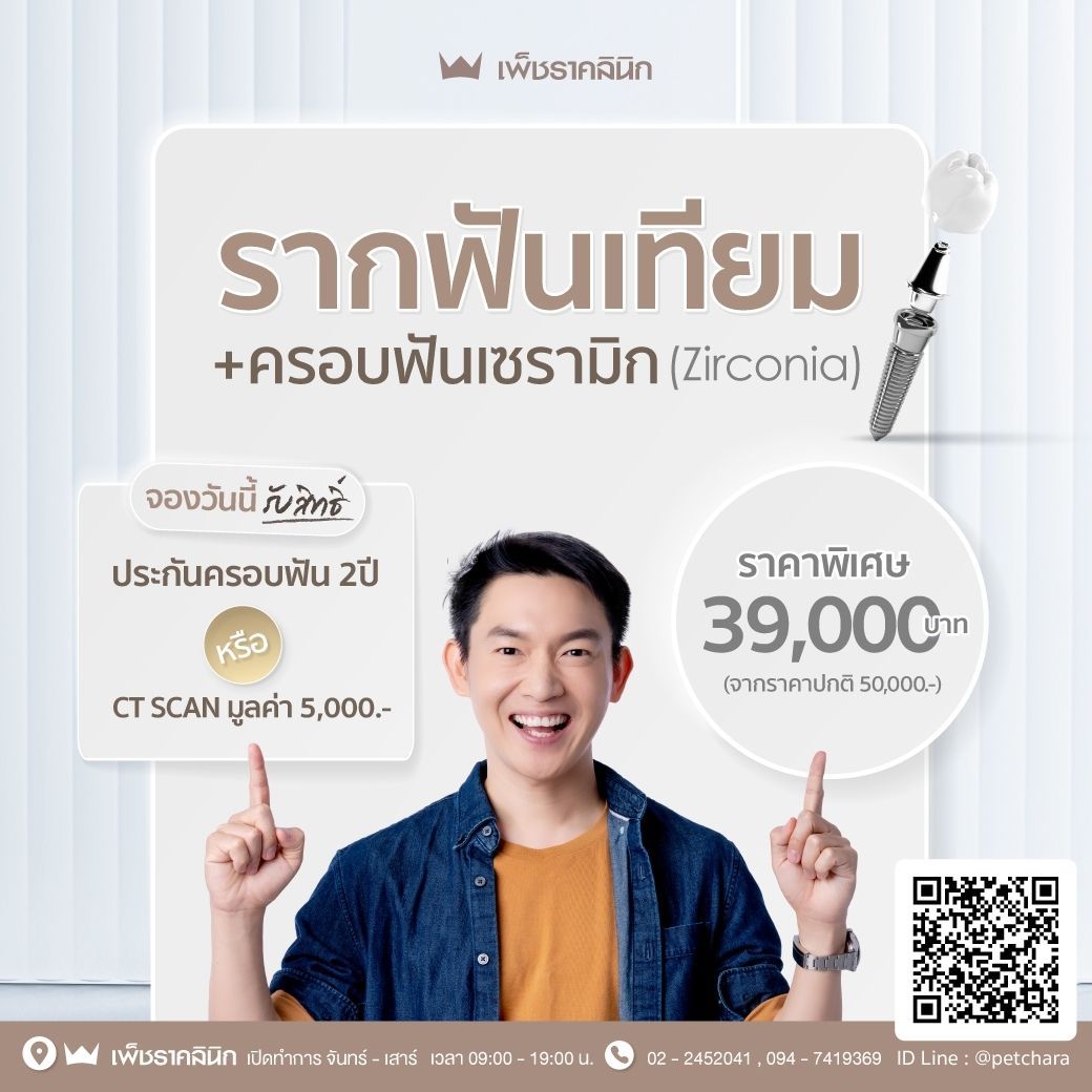 รากฟันเทียมอยู่ได้กี่ปี? ปัจจัยอะไรบ้างที่ส่งผลต่ออายุการใช้งาน