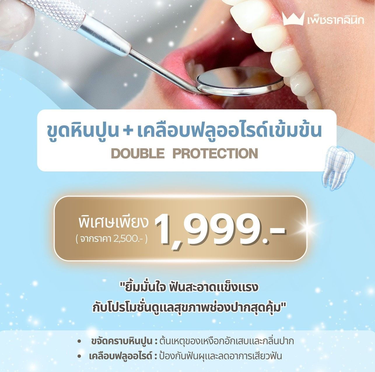 ขูดหินปูน + เคลือบฟลูออไรด์เข้มข้น
DOUBLE PROTECTION — ดูแลช่องปากแบบครบจบในครั้งเดียว