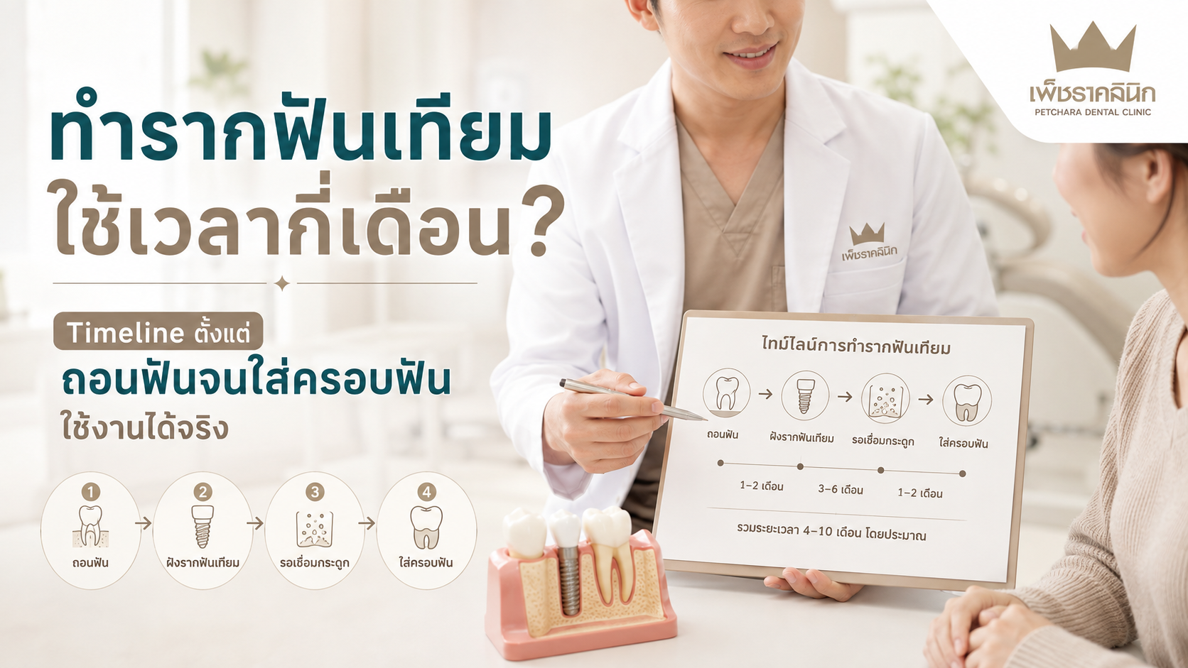 dental-implant-treatment-timeline-duration-guide