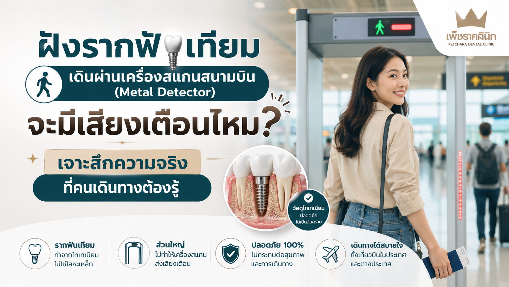 do-dental-implants-set-off-airport-metal-detectors