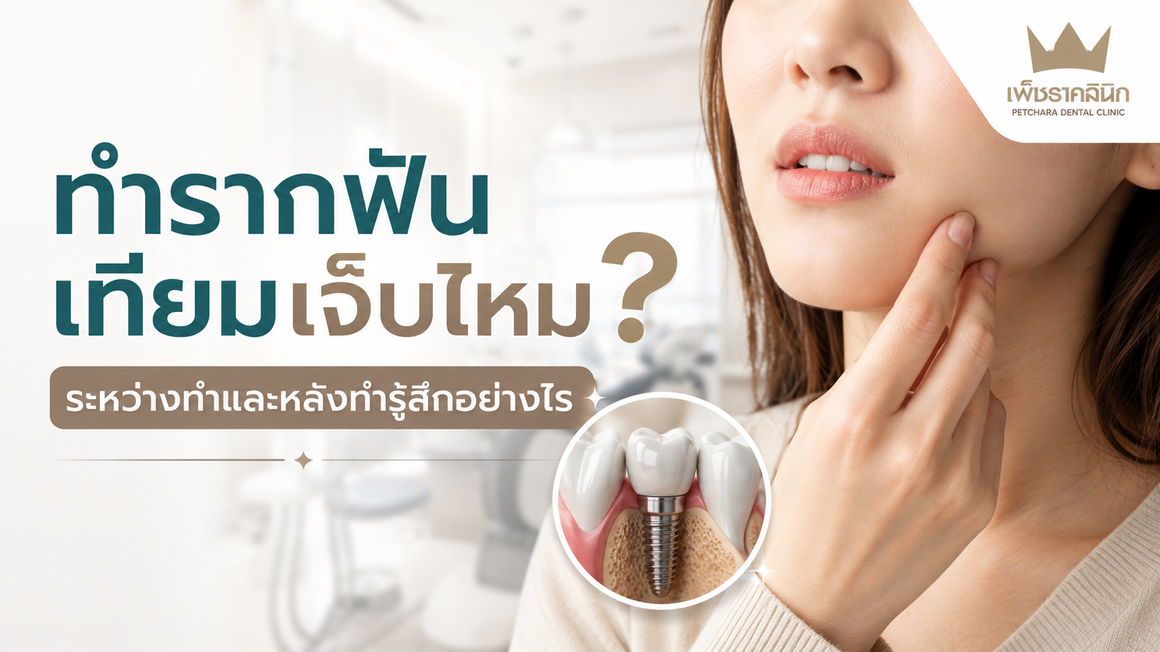 is-dental-implant-painful-procedure-recovery-guide