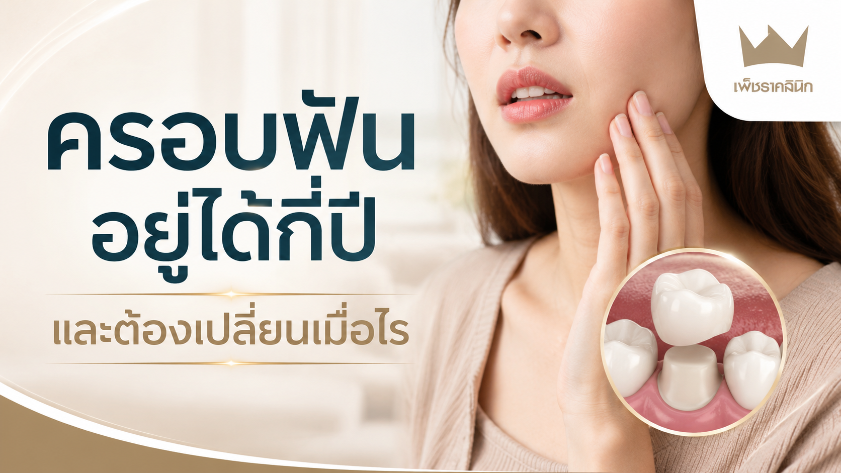 ครอบฟันอยู่ได้กี่ปี และต้องเปลี่ยนเมื่อไร? คู่มือเจาะลึก 7 สัญญาณเตือนและการดูแลรักษา