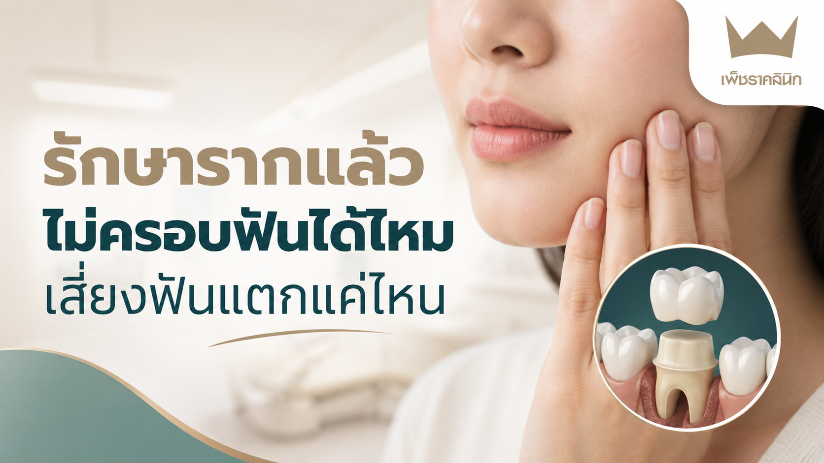 รักษารากแล้วไม่ครอบฟันได้ไหม? เสี่ยงฟันแตกแค่ไหน? คู่มือเจาะลึก 4 ความเสี่ยงวิกฤตที่คุณต้องรู้